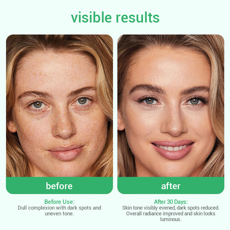 private label whitening serum